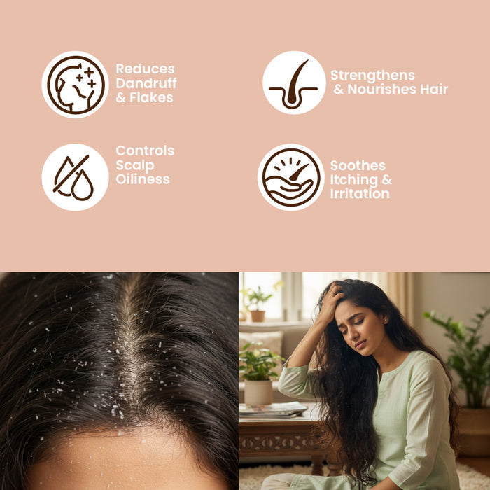 ANTI DANDRUFF SERUM