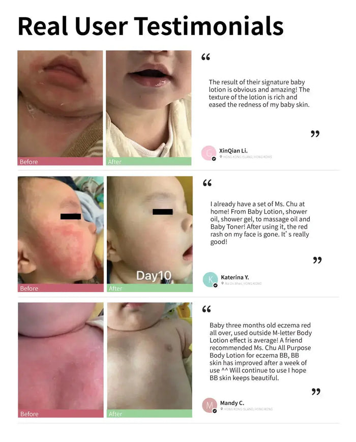 Baby Eczema Combo - Ms. Chu Soap & Beaut
