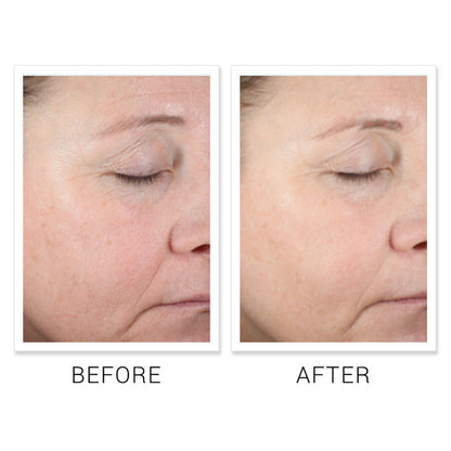 Ultra Hydrating HA Serum